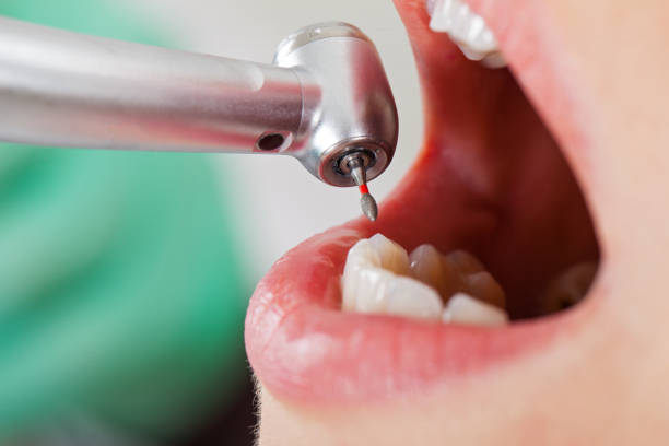 Best Walk-In Emergency Dentist in Guthrie, OK